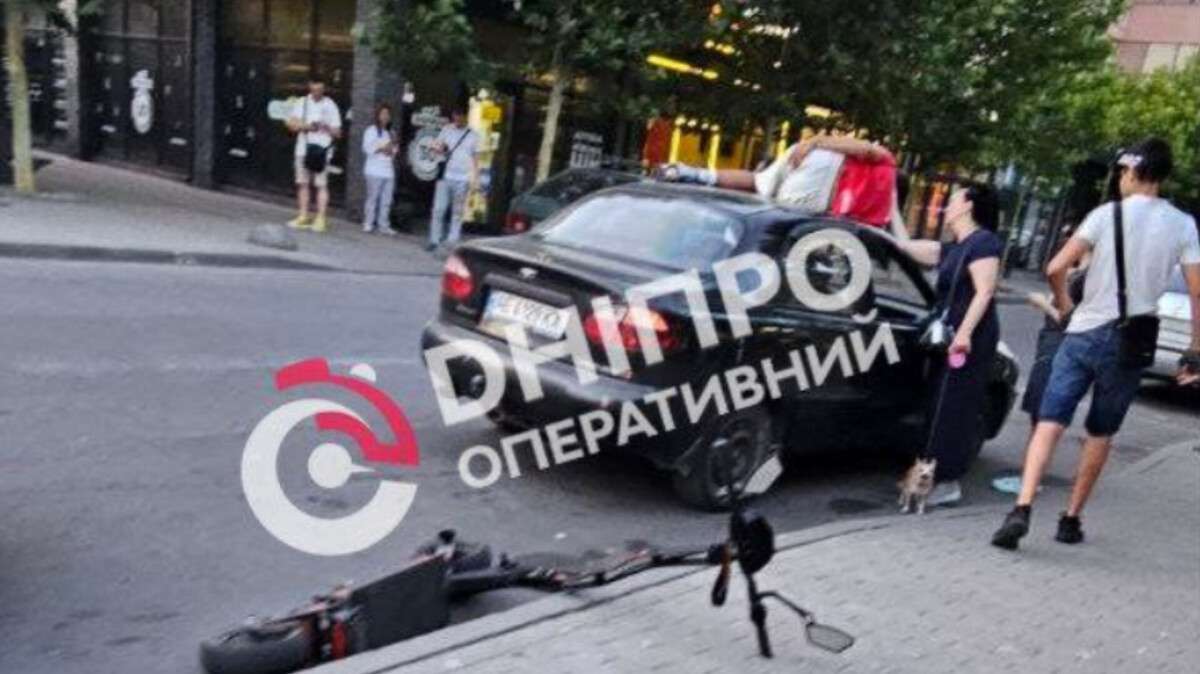 Підліток на електросамокаті врізався в авто - у якому він стані